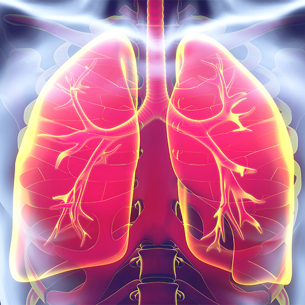 Lungs, Pulmonary; Conceptual Image
