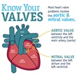 CardioSmart Valves