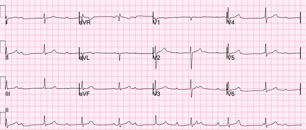 Image 1: Twelve-Lead Electrocardiogram on Presentation