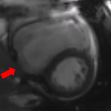 Video 3
