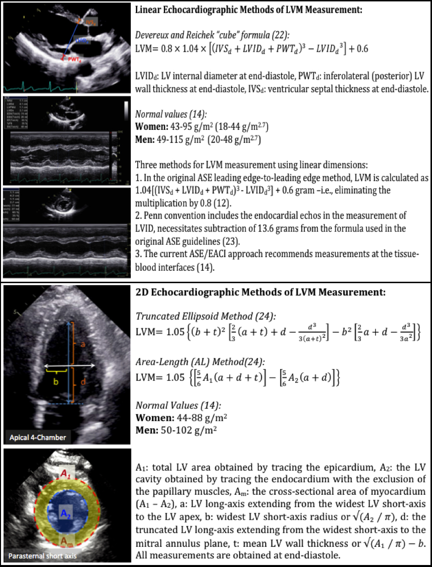 Approaches To Echocardiographic Assessment Of Left Ventricular Mass What Does Echocardiography Add American College Of Cardiology