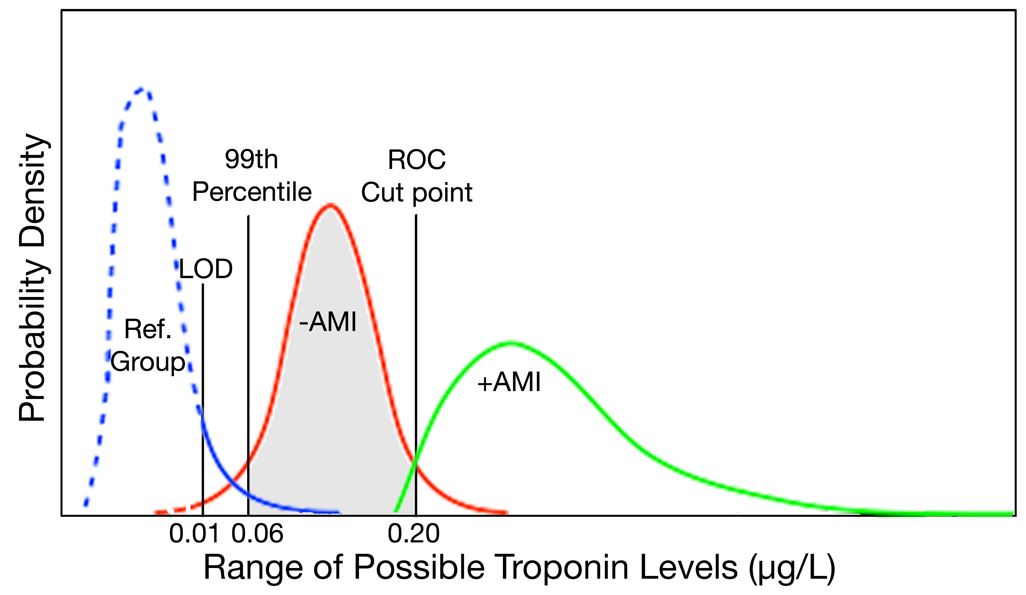 Normal troponin levels: Healthy ranges and what high levels mean