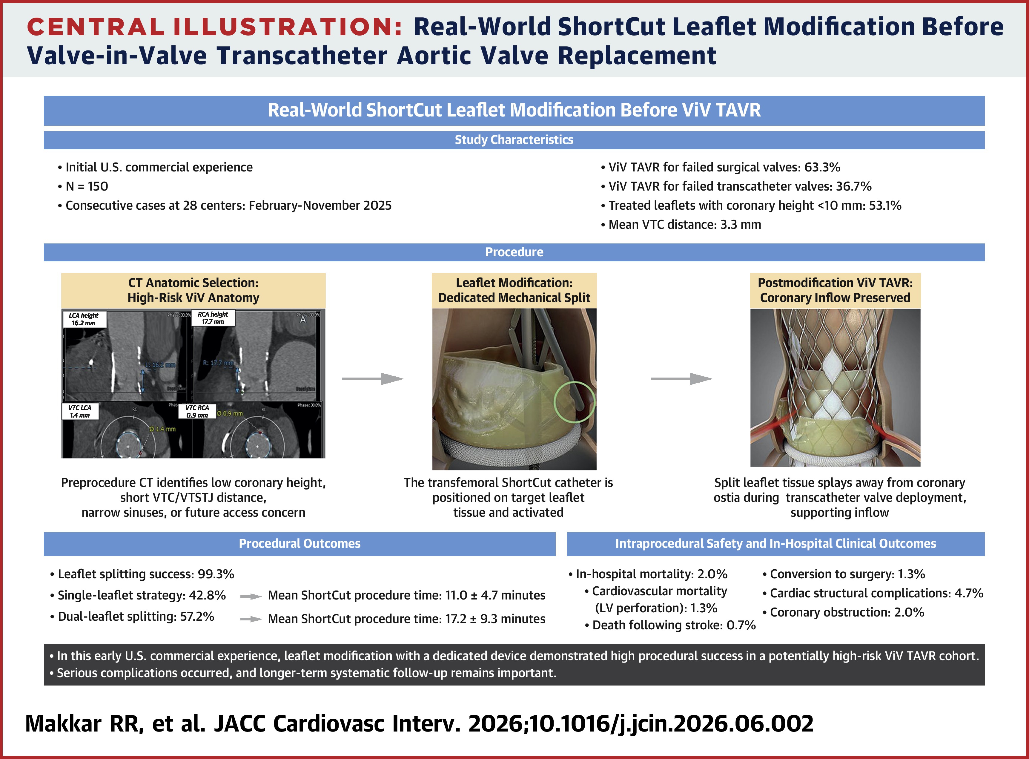 JACC Central Illustration: Real-World ShortCut Leaflet Modification Before ViV TAVR