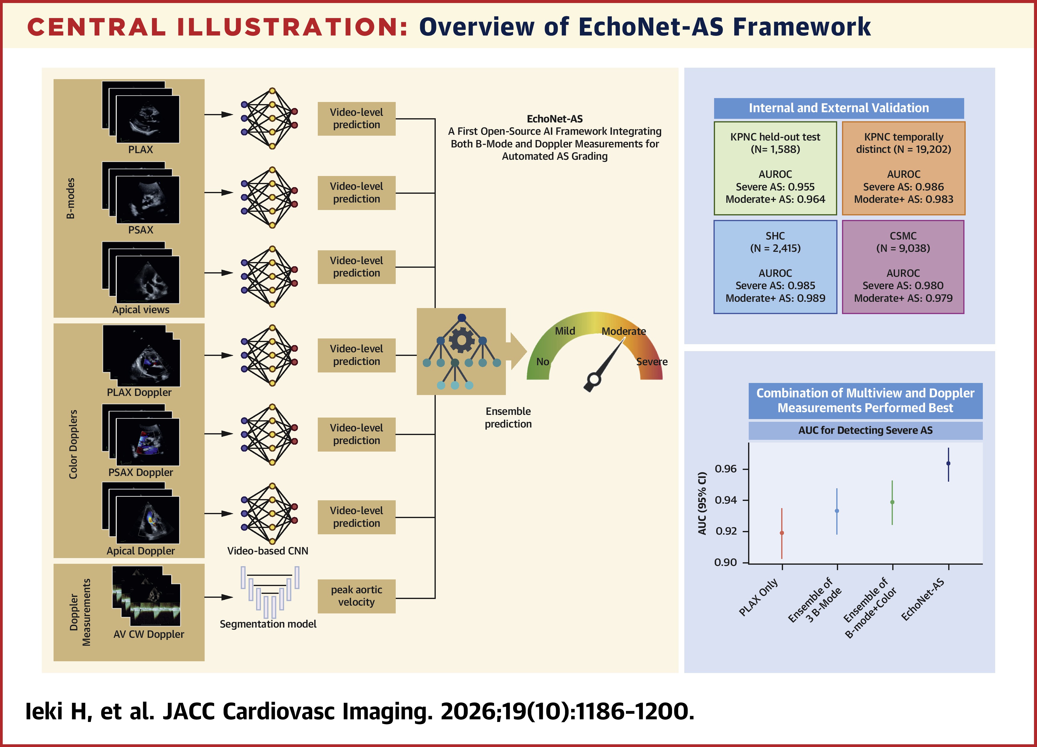 JACC Central Illustration - Overview of EchoNet-AS Framework.