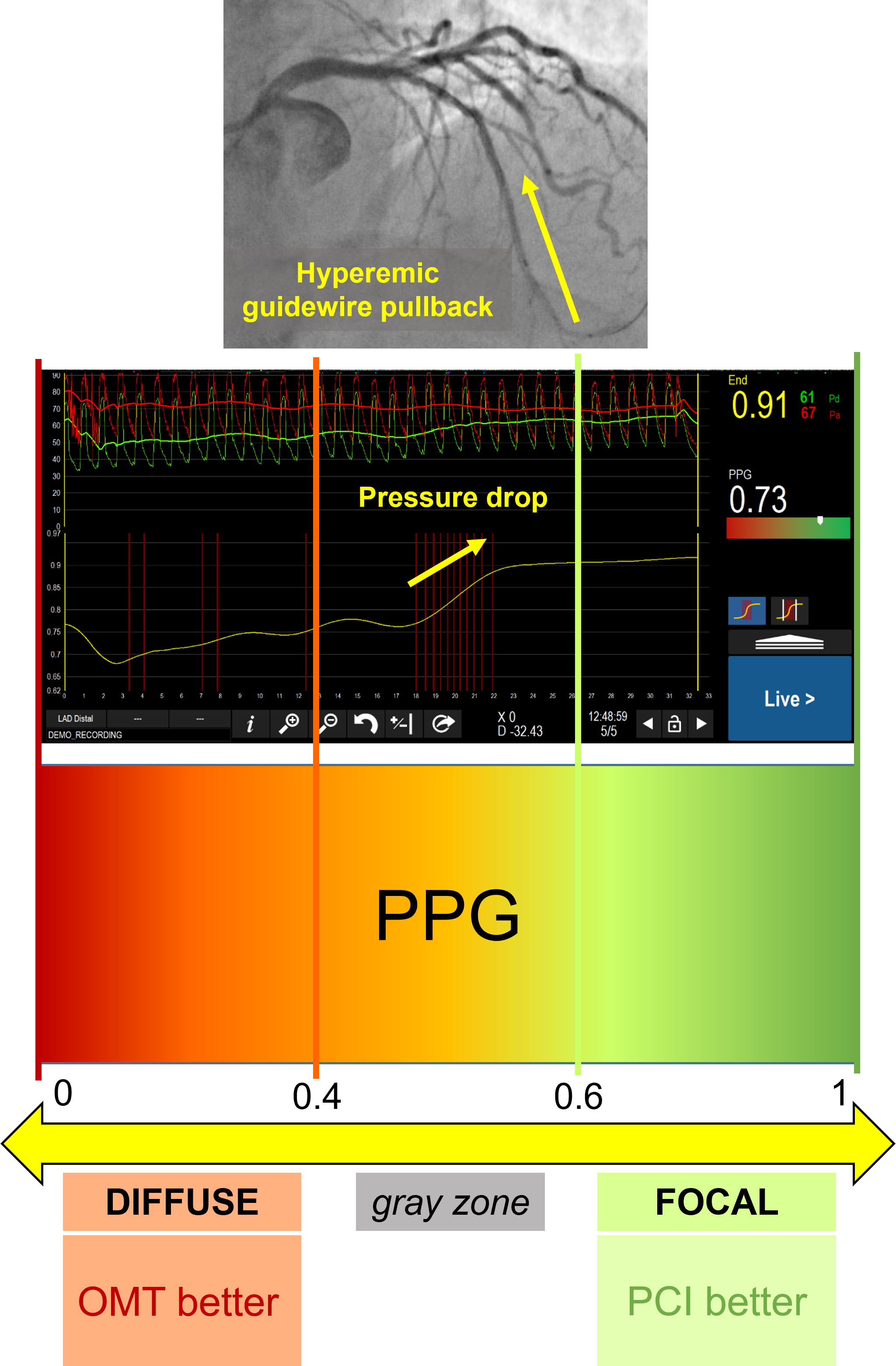 Figure 1: PPG Index for Physiological Pattern Recognition and Clinical Decision-Making