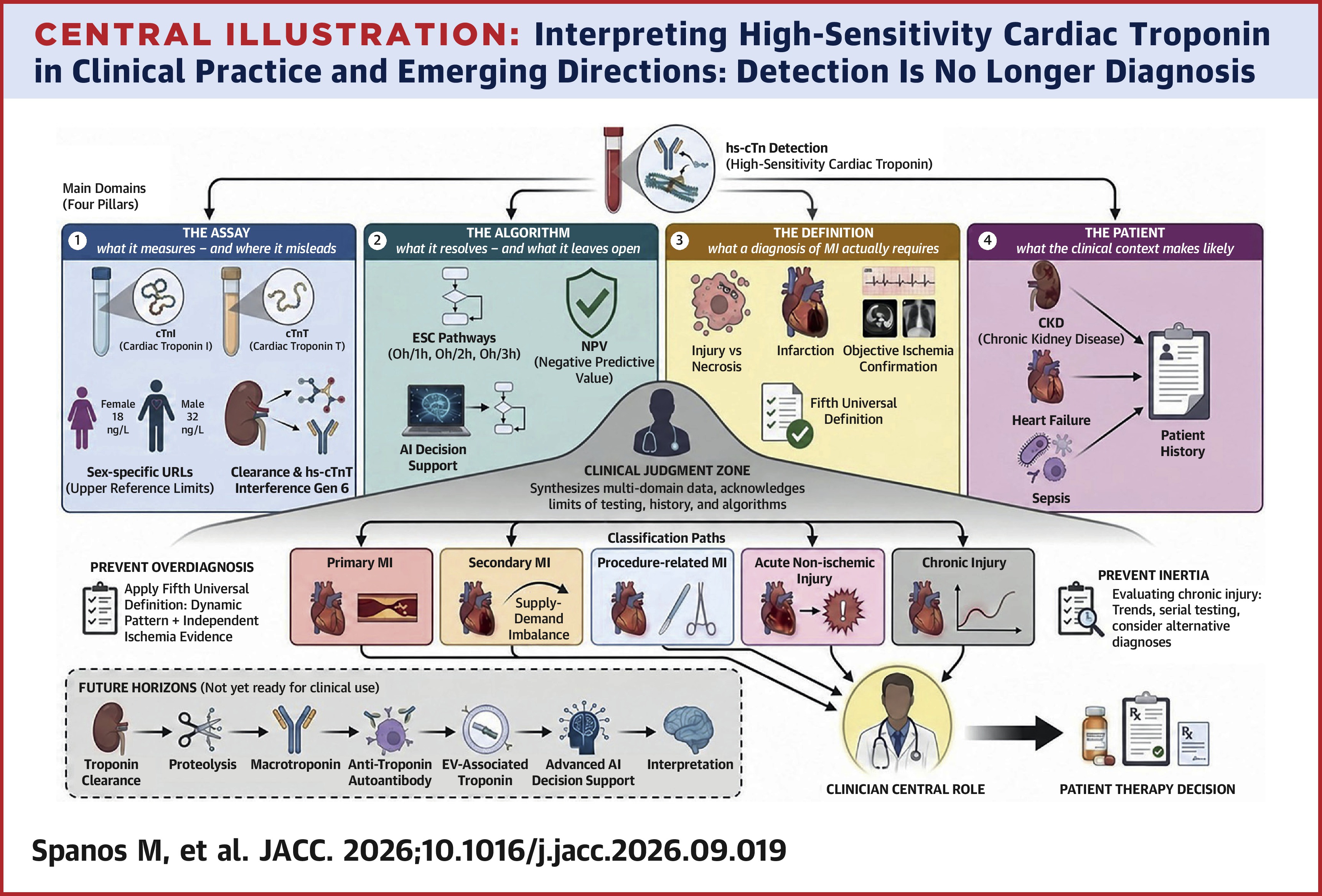 JACC Central Illustration depicting the four central pillars of practice in interpreting high-sensitivity cardiac troponin.
