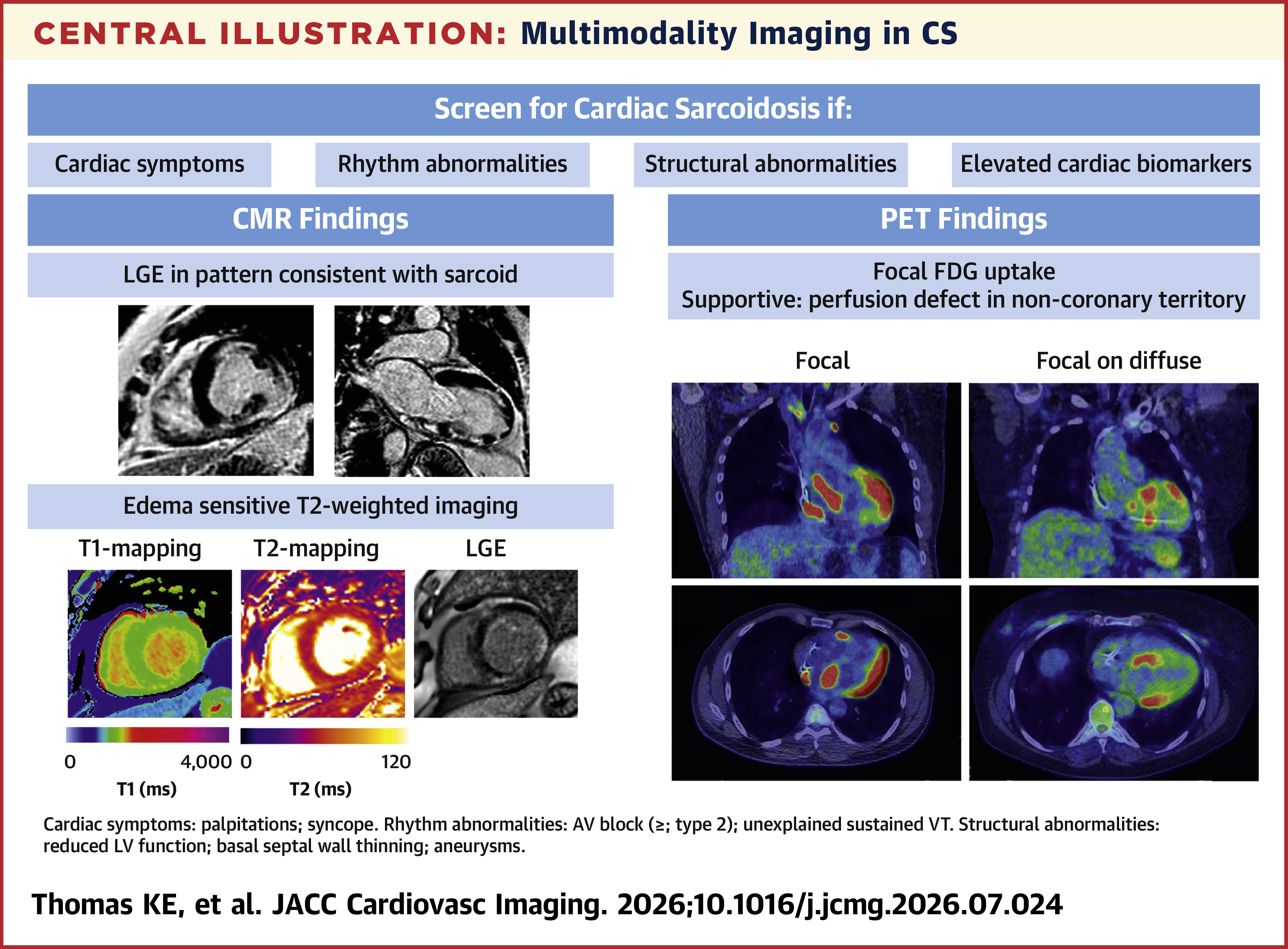JACC Central Illustration illustrating use of multimodality imaging in diagnosing and evaluating CS.