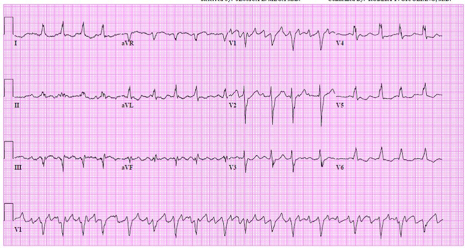 51-Year-Old With Dyspnea and Palpitations