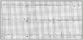 Figure 1: A 72-Year-Old Asymptomatic Man Presenting for Routine Follow-Up