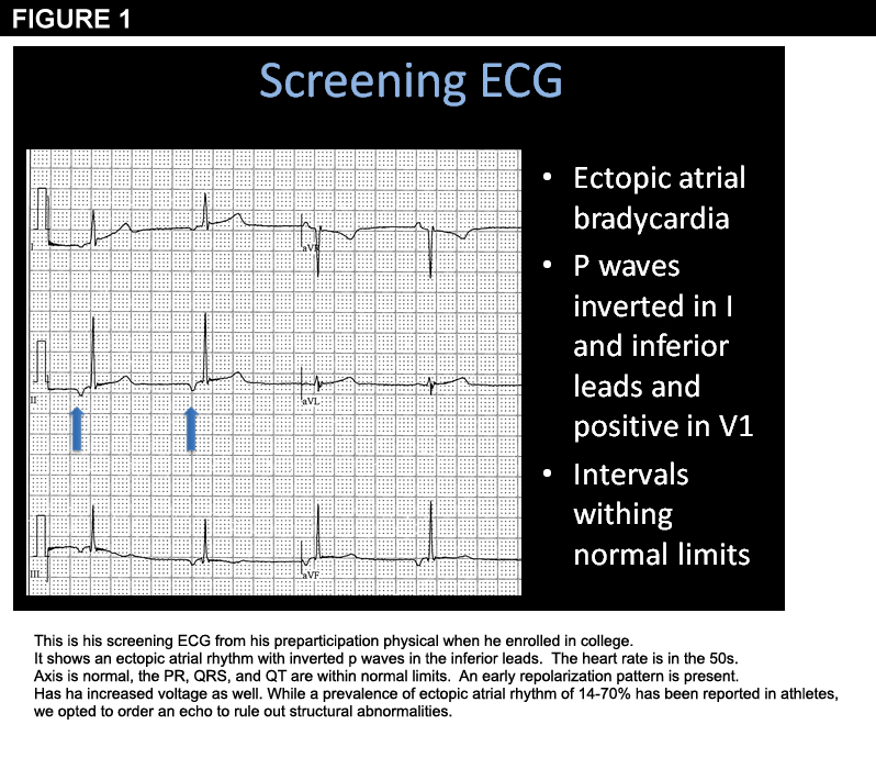 The ECG (Figures 1 and 2) showed the following: