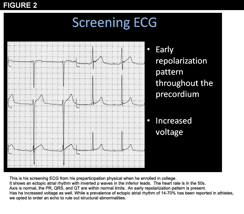 The ECG (Figures 1 and 2) showed the following: