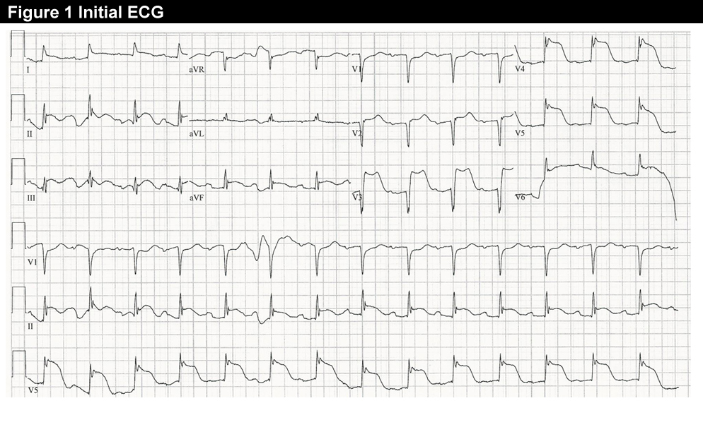Figure 1: Treating a 55-Year-Old With Severe, Substernal Chest Pain, Nausea, Vomiting and Left Arm Radiation