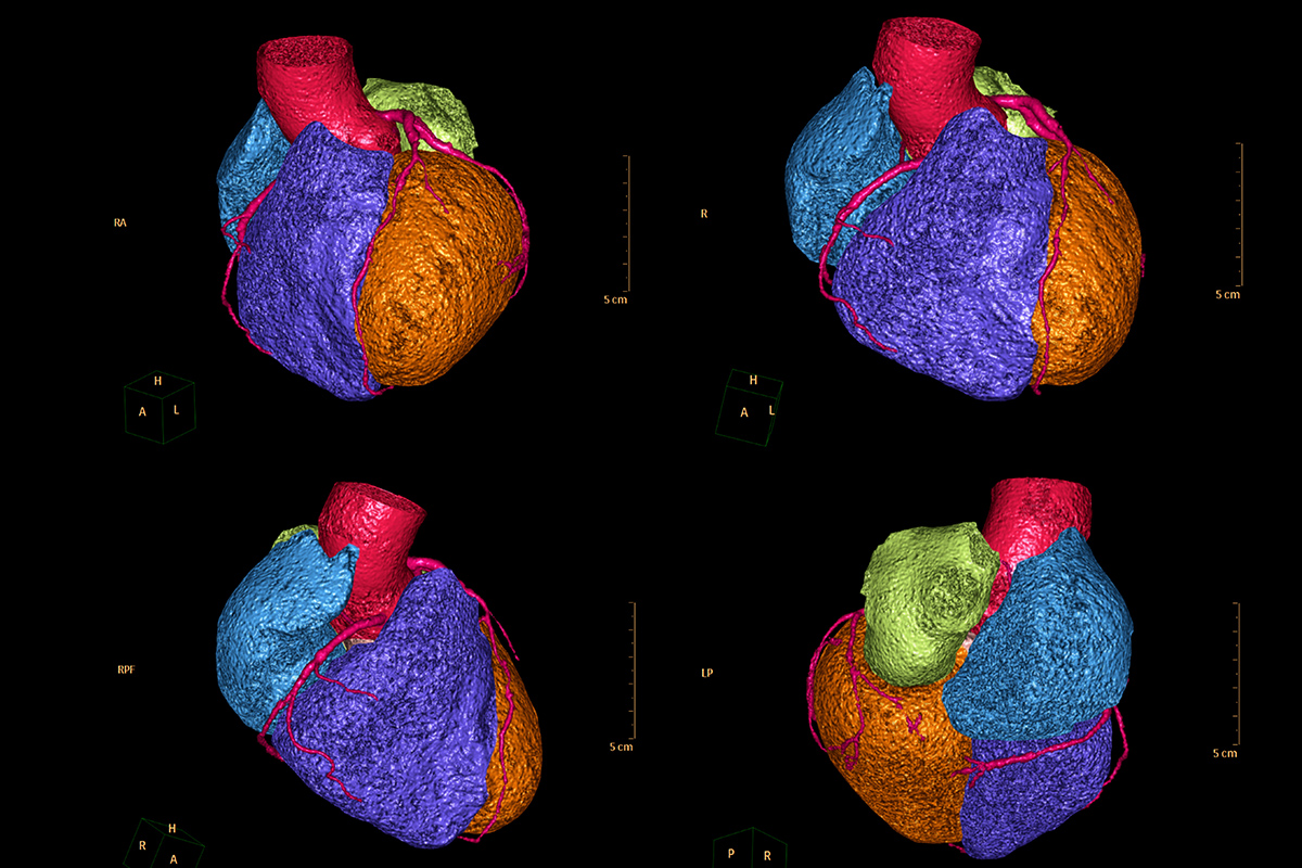 Cardiology Magazine Image