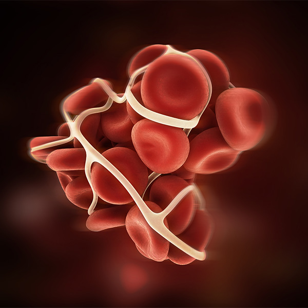 Thrombosis, blood clotting; Conceptual Image