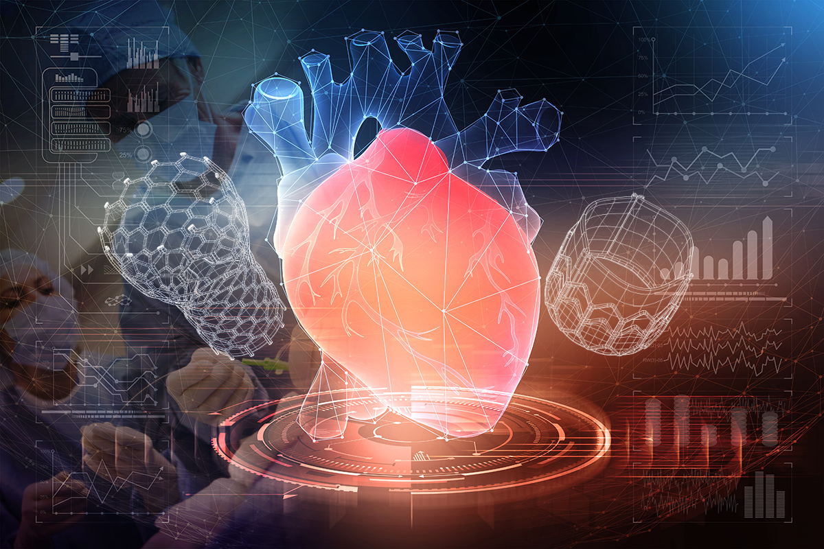 TAVR, Interventional; Conceptual Image