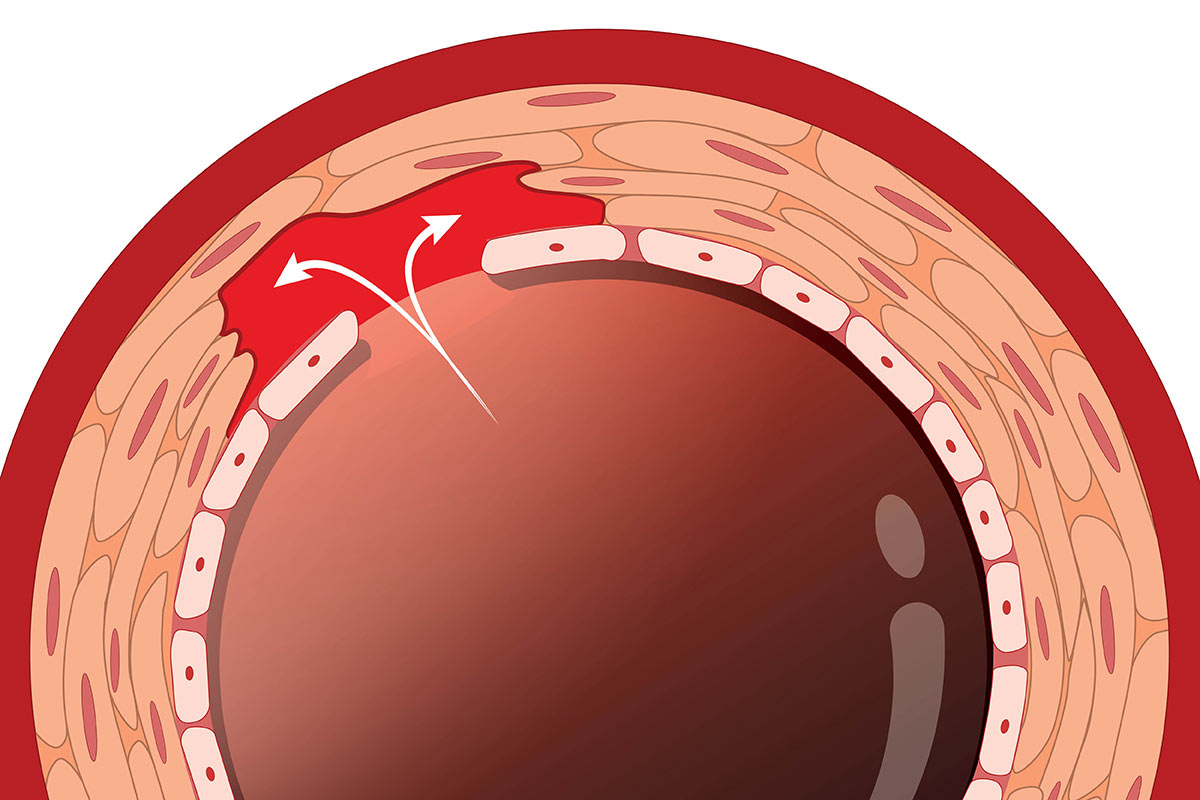 Cardiology Magazine Image