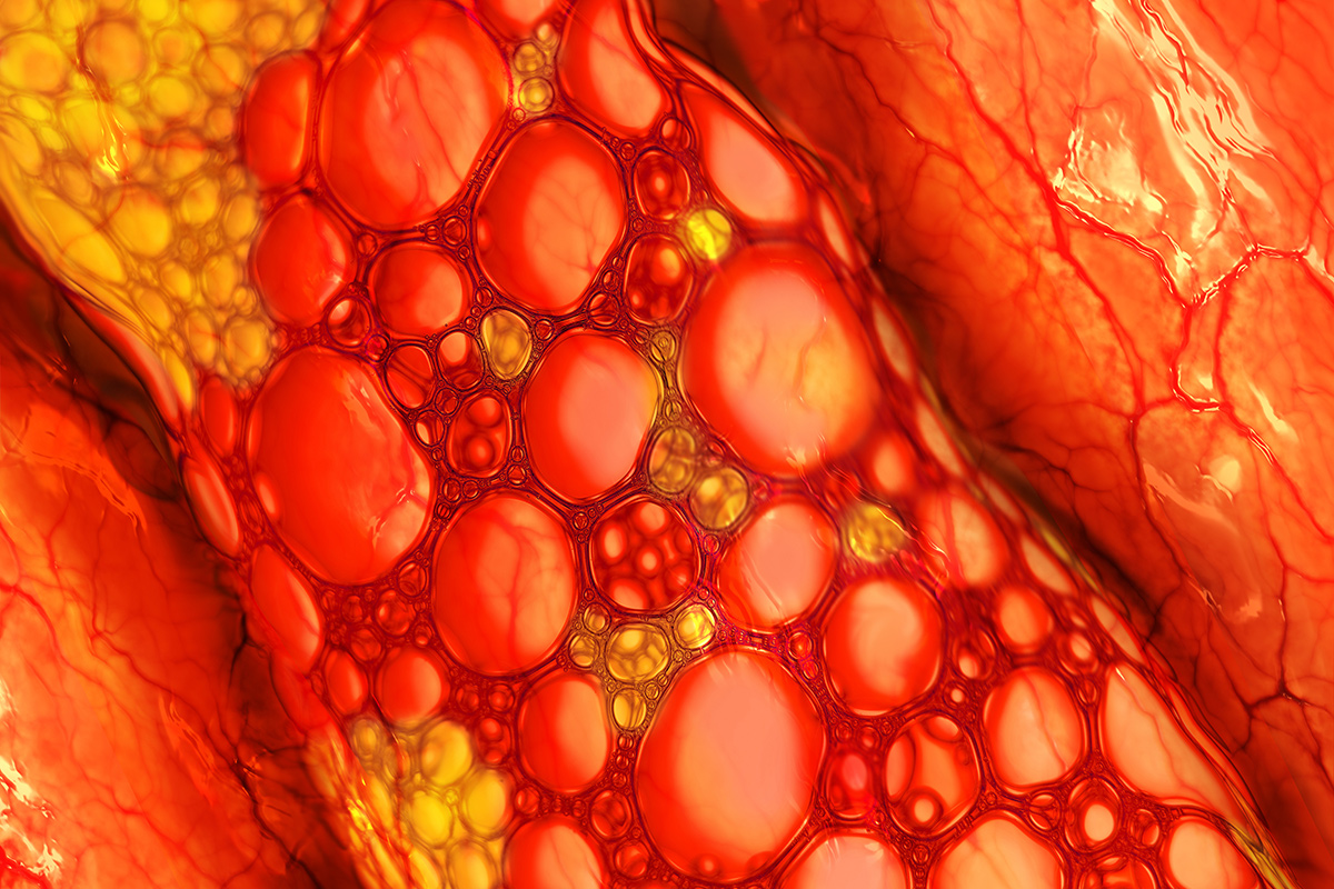 Blood Cholesterol; Conceptual Image