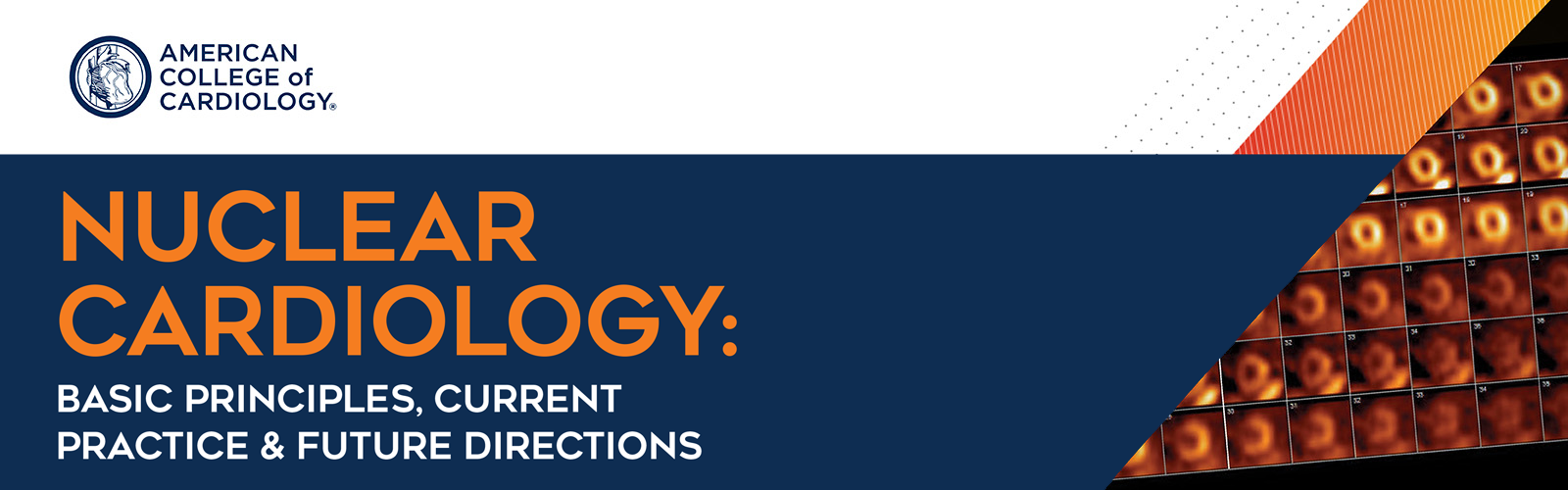 Clinical Nuclear Cardiology: from the Nuts and Bolts to the Recent Advances