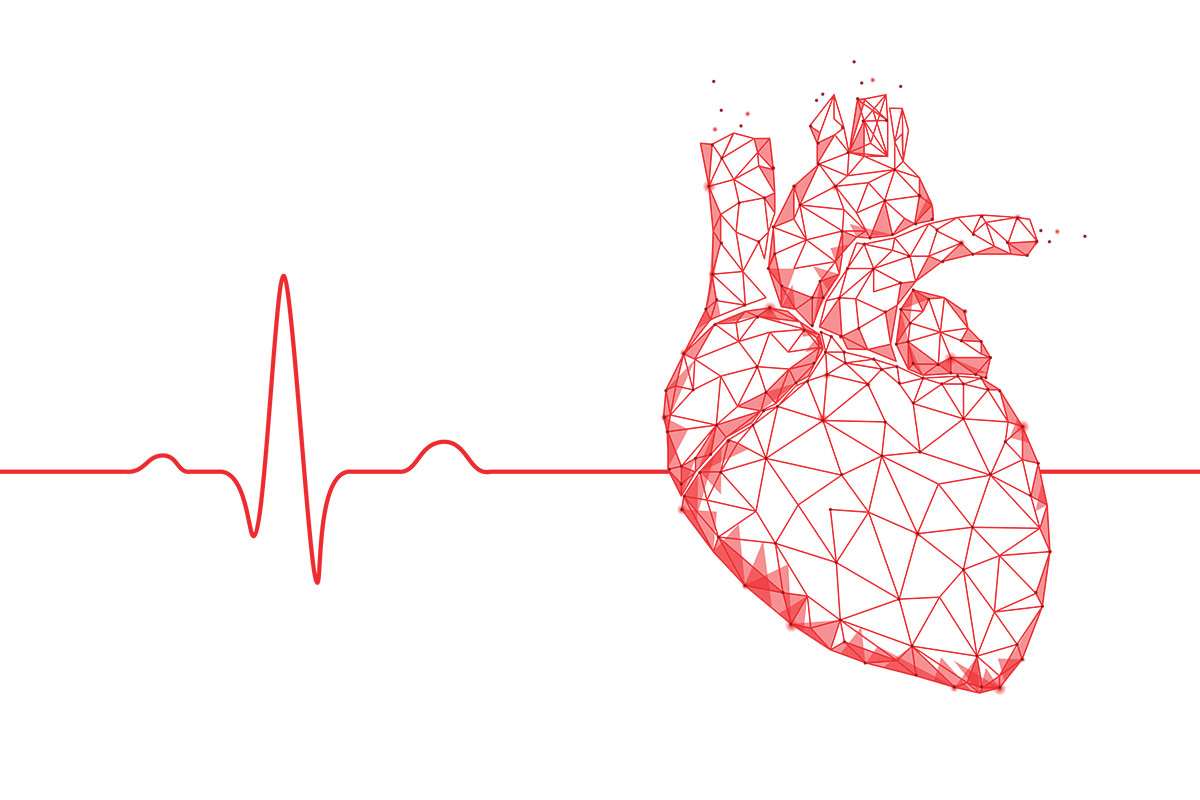 Focus on EP | Heart Rhythm 2022: My Top Five - American College of  Cardiology