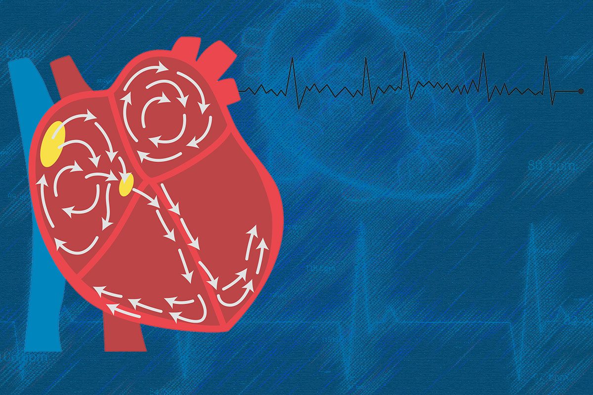 Rhythm or Rate Control – Still a Conundrum For Clinicians