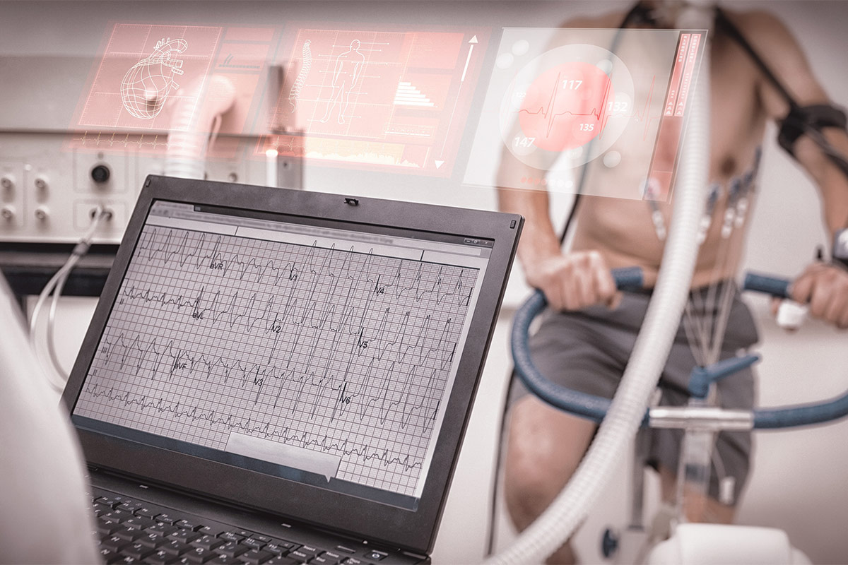 Coronary Microvascular Disease in Patients With Obstructive CAD