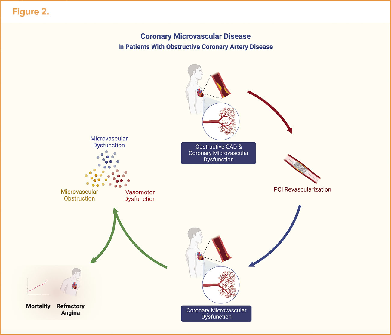 Coronary Microvascular Disease in Patients With Obstructive CAD