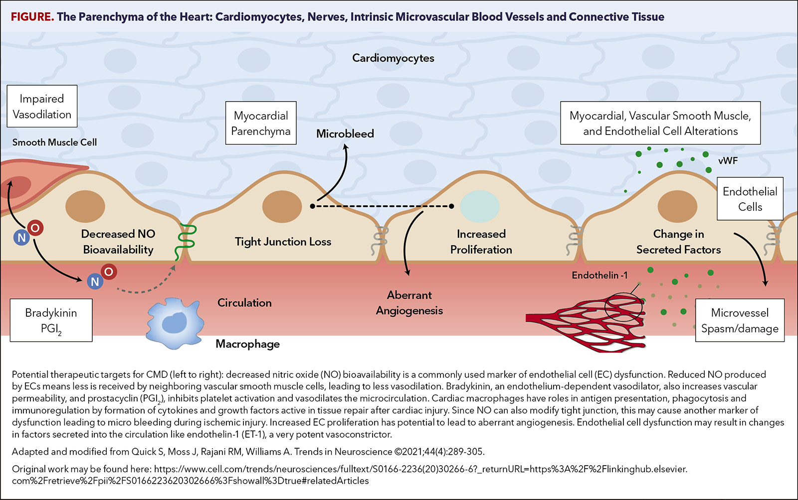 Treatment Options For Coronary Microvascular Dysfunction