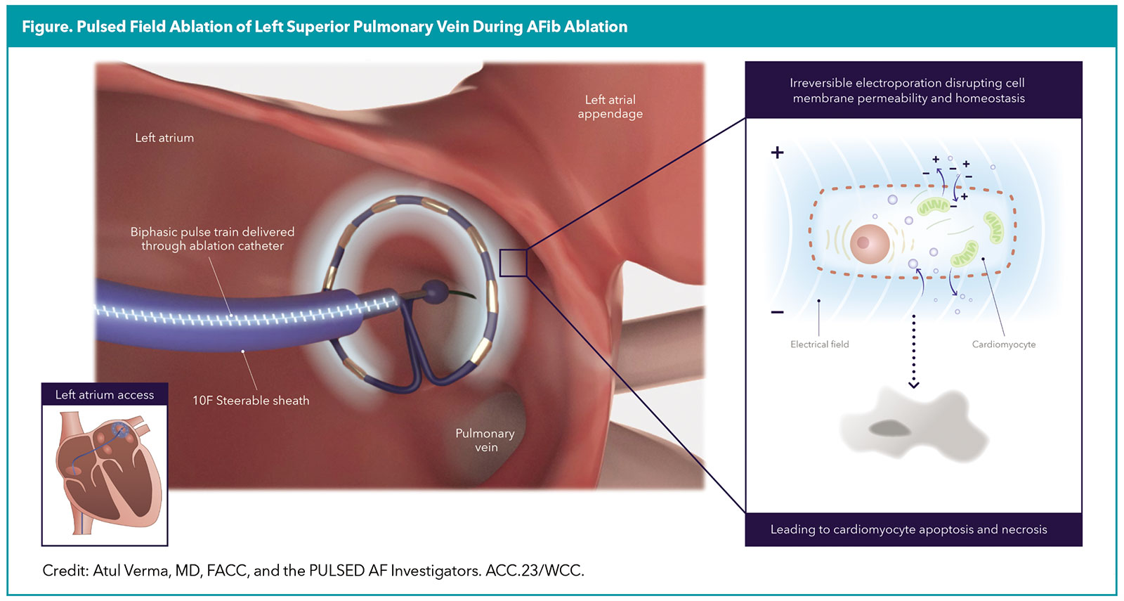 Eager for All the Latest in Electrophysiology? This CME Summit's