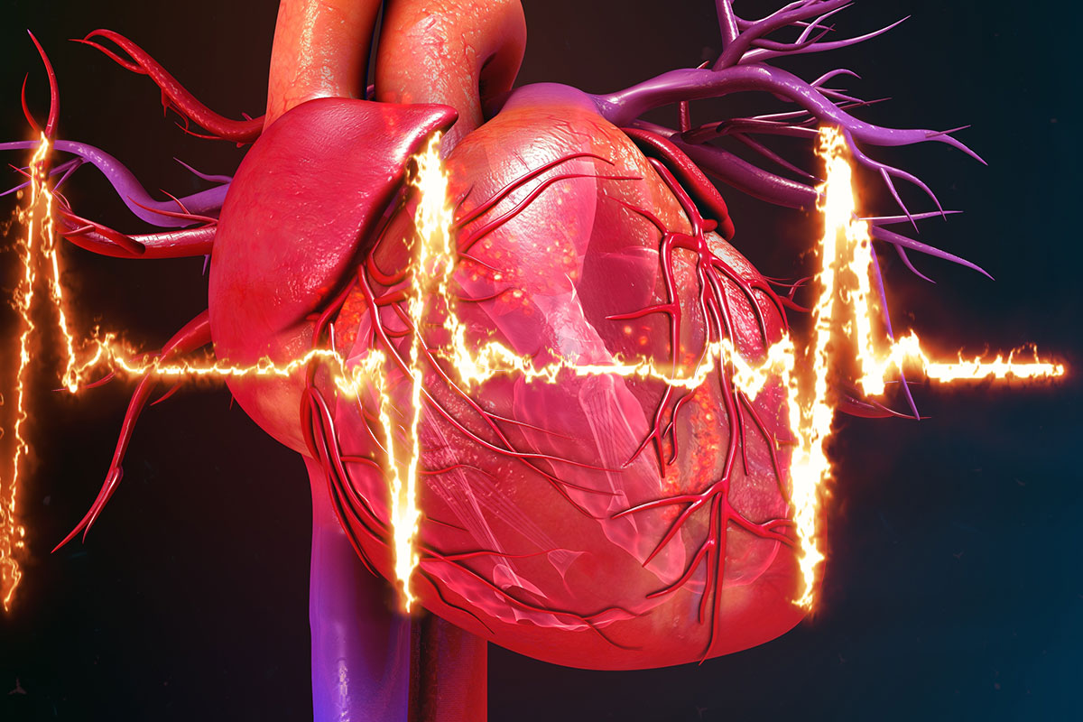 Advanced Imaging in Cardiomyopathies