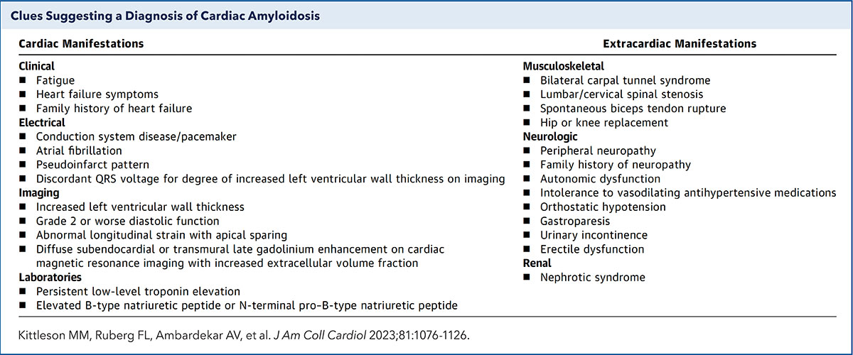 Cardiac Amyloidosis and How to Stop Missing the Diagnosis