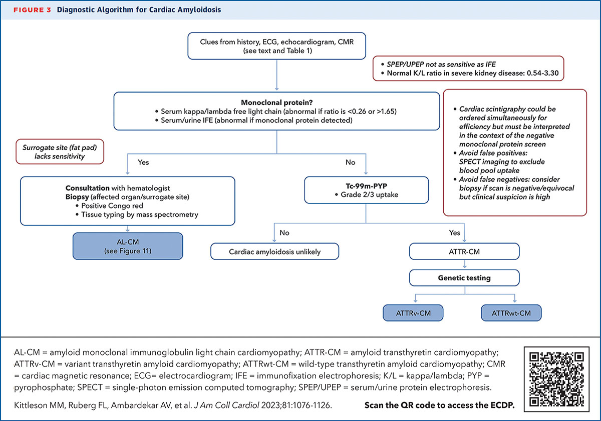 Cardiac Amyloidosis and How to Stop Missing the Diagnosis