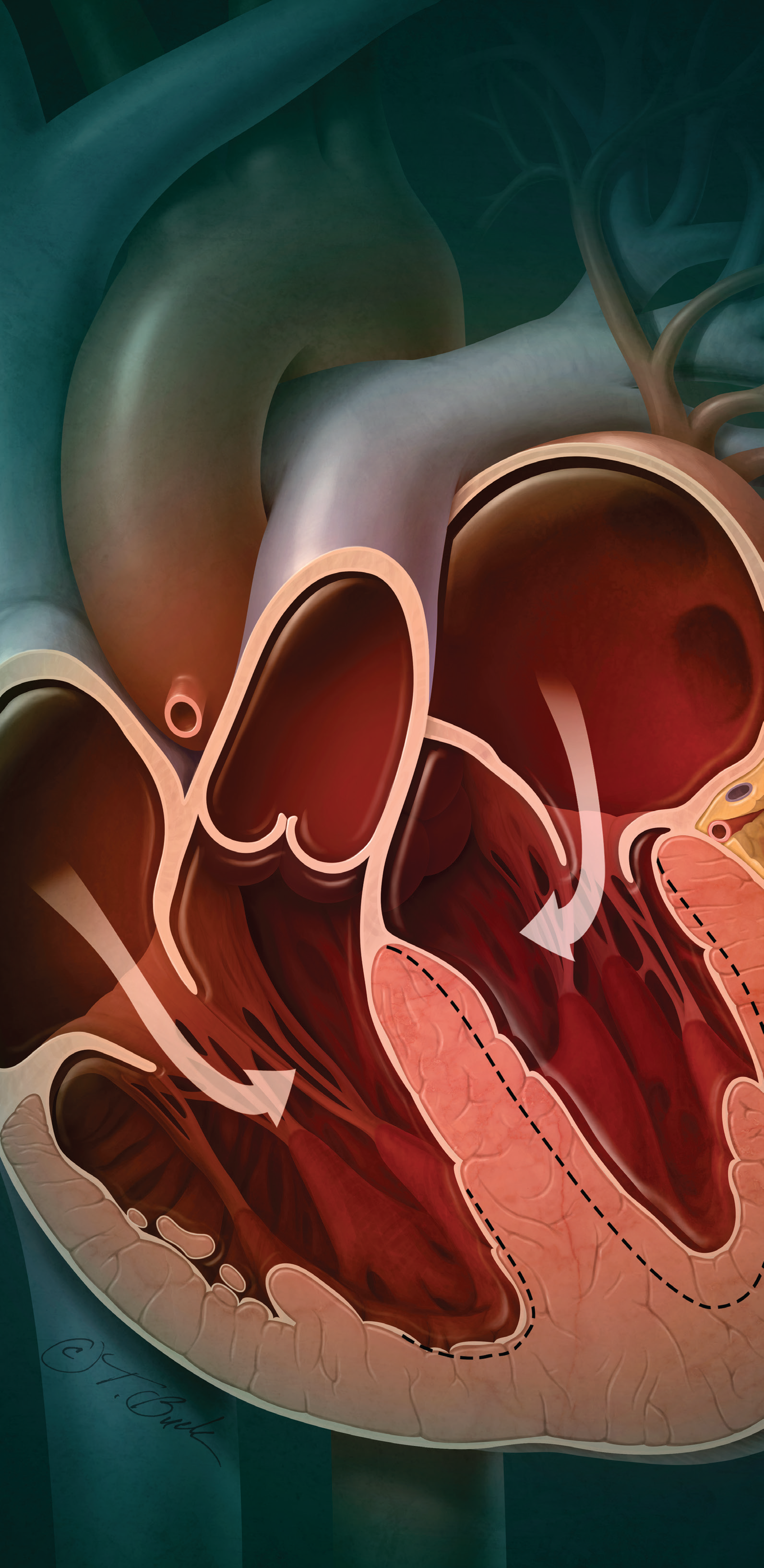 The Adipokine Hypothesis: A New Framework For Understanding HFpEF