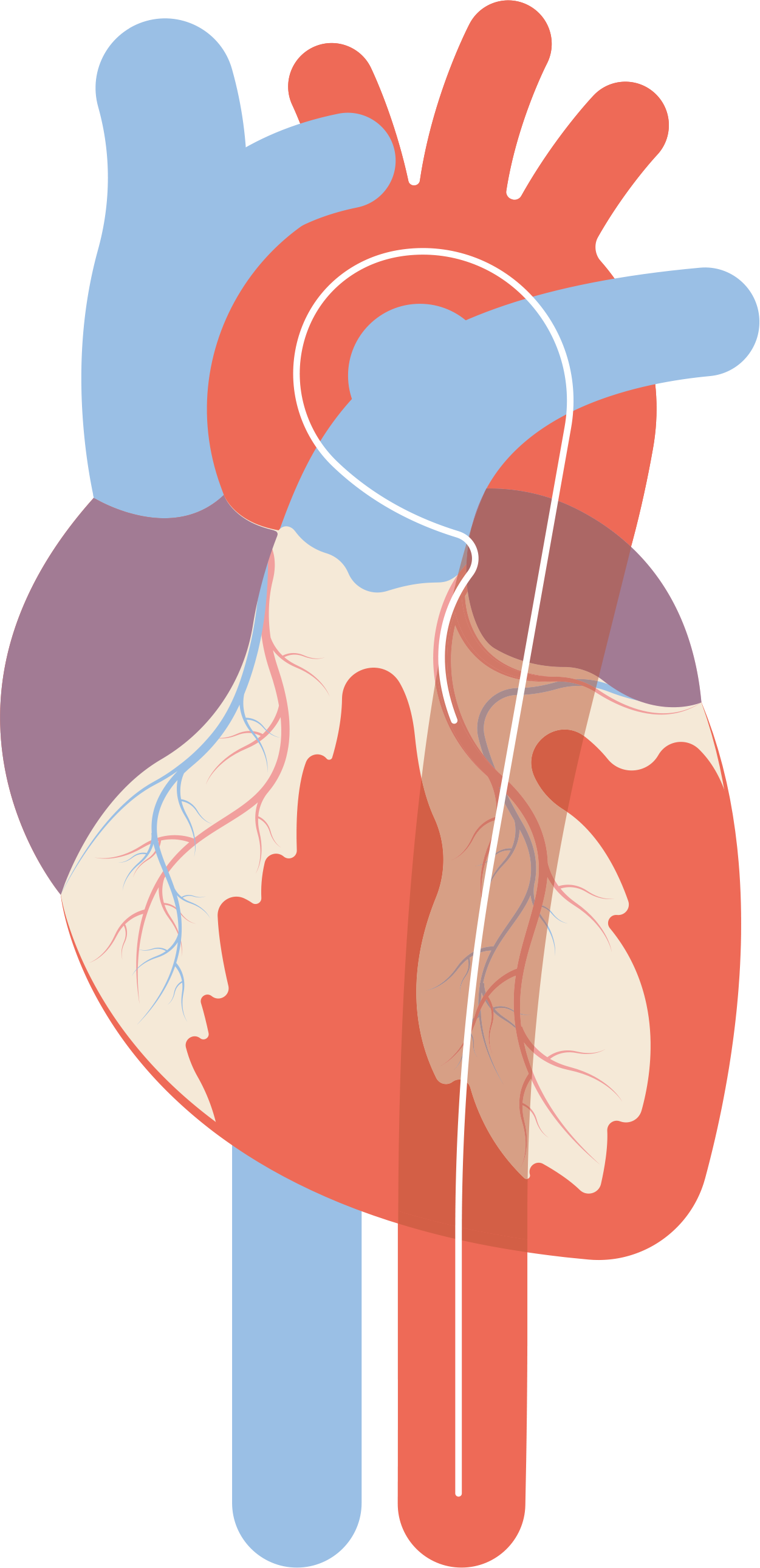 From Evidence to Action: Recent Trials Influencing Interventional Strategy