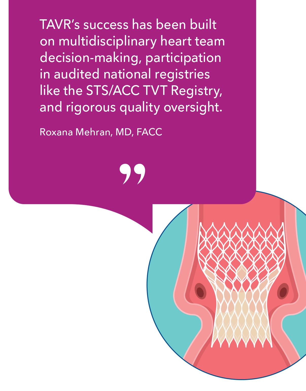'TAVR's success has been built on multidisciplinary heart team decision-making, participation in audited national registries like the STS/ACC TVT Registry, and rigorous quality oversight.' - Roxana Mehran, MD, FACC
