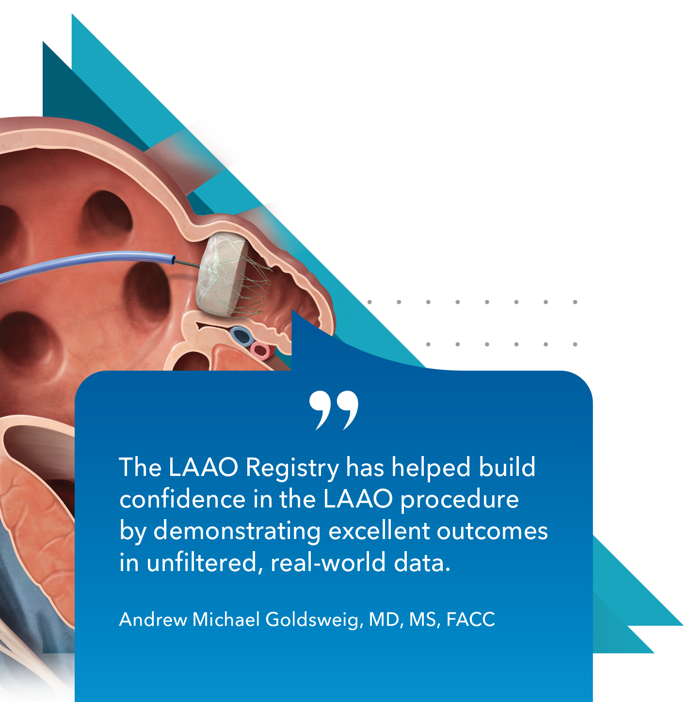 The LAAO Registry has helped build confidence in the LAAO procedure by demonstrating excellent outcomes in unfiltered, real-world data.