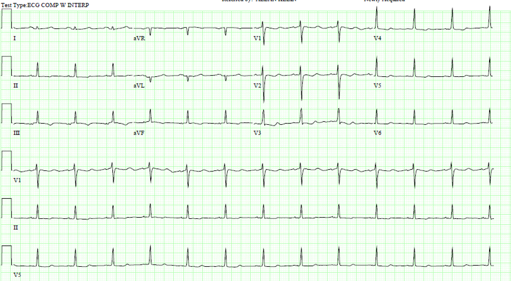 ECG 1