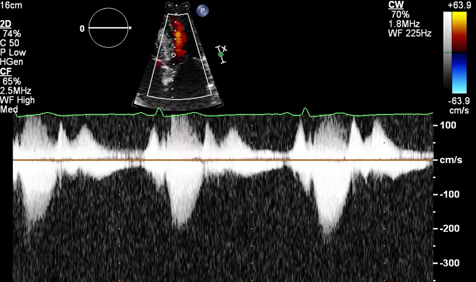 Figure 2