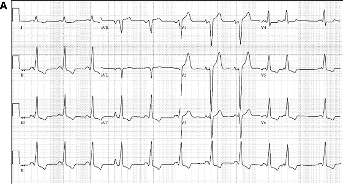 Figure 1A