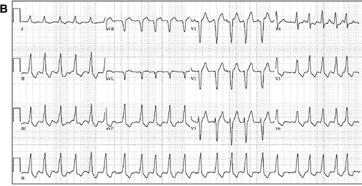 Figure 1B