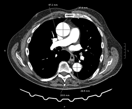 Figure 1B