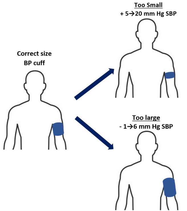 Most Americans need a large or extra-large blood pressure cuff