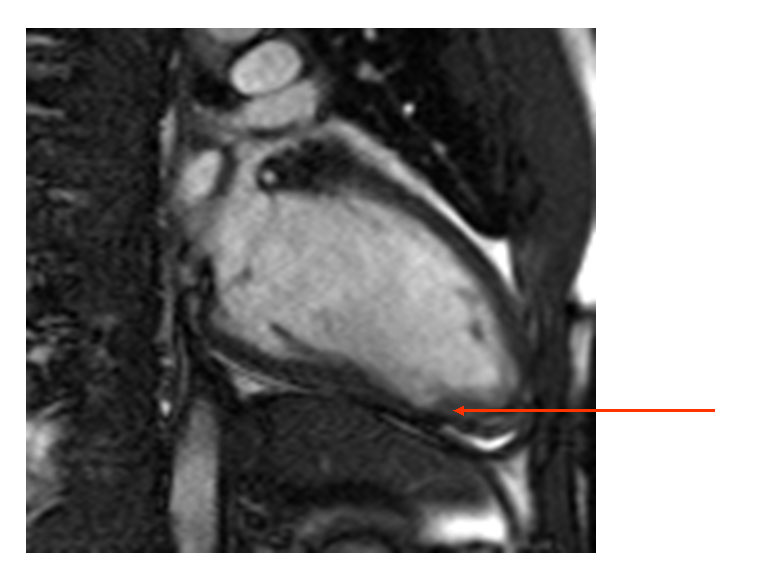 Figure 2A: A 29-Year-Old Black Male Presents to the Emergency Department with Chest Pain