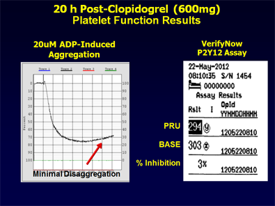 Figure 1: 20h Post-Clopidogrel (600mg) Platelet Function Results